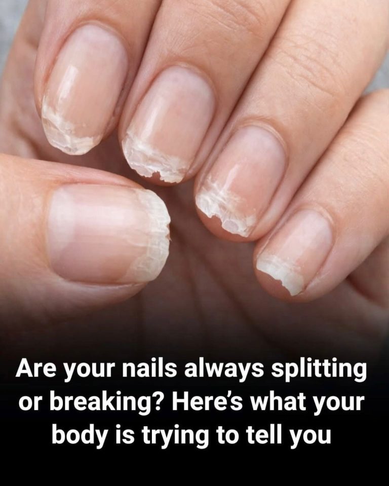 Gyenge vagy töredező körmök: Mit próbál üzenni a tested?